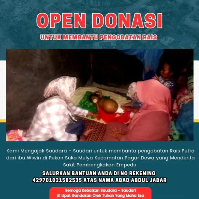 
Muhammad Rais, Anak 3 Tahun di Pekon Sukamulya Butuh Kebajikan untuk Atasi Pembengkakan Hati