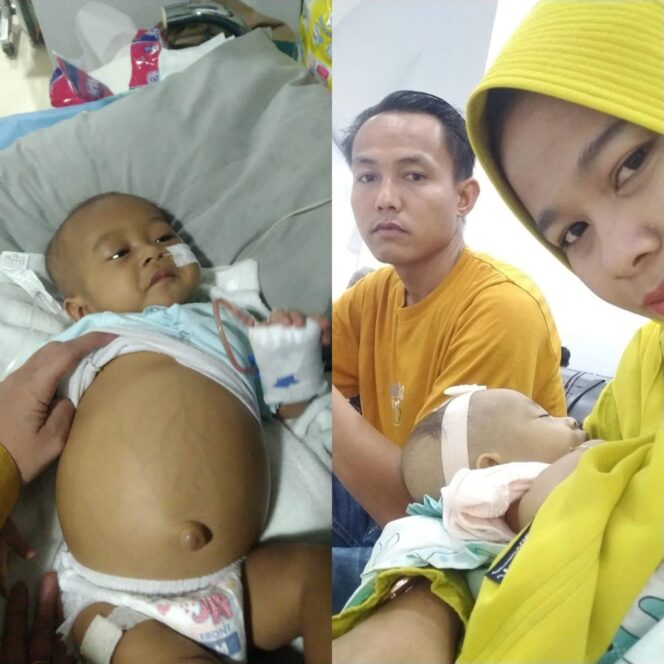 
Bayi 8 Bulan Penderita Atresia Bilier Harapkan Bantuan Pemkab Tubaba
