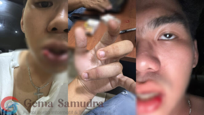 
Ketua SMSI Lampung Protes, Laporan Balik Tetap Diproses Polda Meski HS Berstatus Tersangka